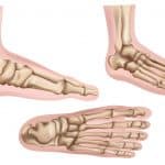 Foot Pain | Anatomy in Motion | Balwyn North