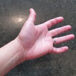 carpal tunnel | wrist pain | tingling hand